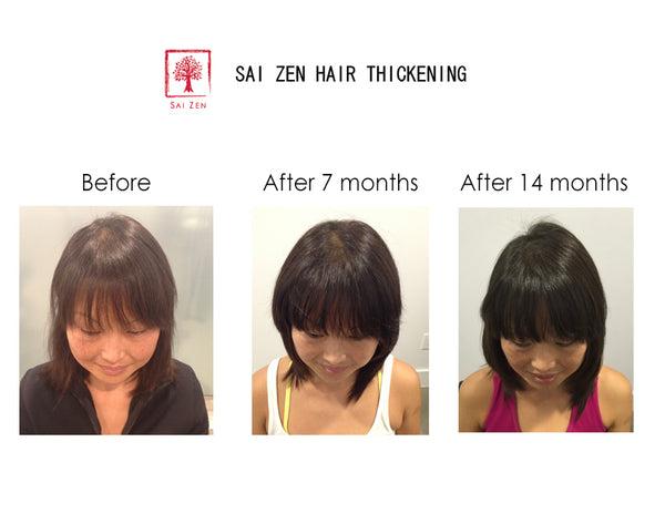 14months usage of Sai Zen Hair Thickening Products