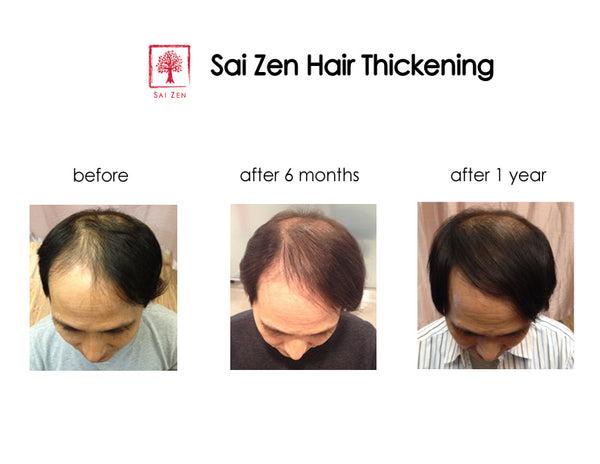 12 months usage of Sai Zen Hair Thickening Products