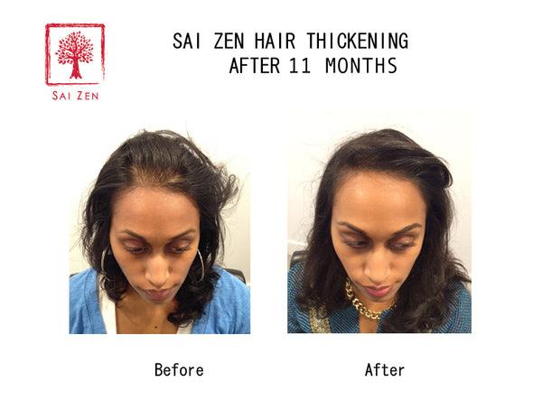 11 months usage of Sai Zen Hair Thickening Products