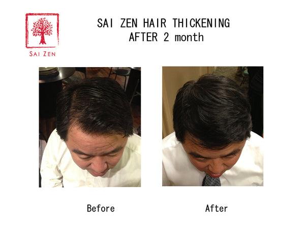 2 months usage of Sai Zen Hair Thickening Products