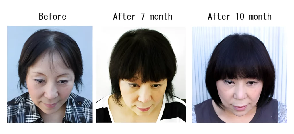 Saizen Shampoo Before and After